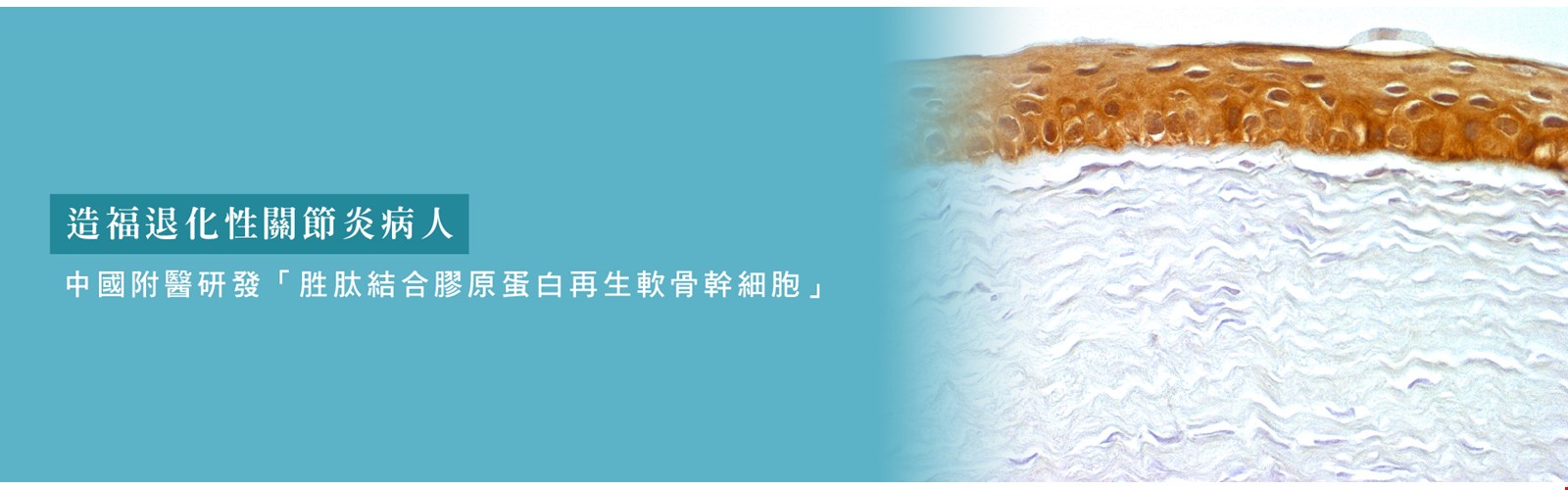 胜肽結合膠原蛋白再生軟骨幹細胞