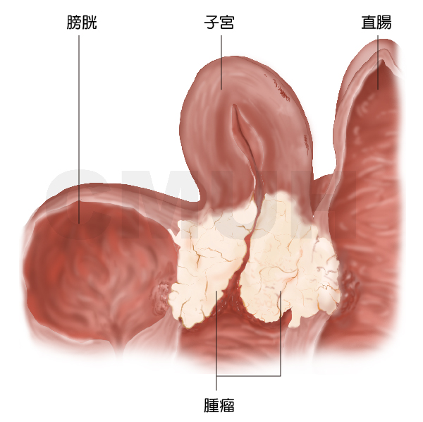 婦科 | 特色介紹 - 中國醫藥大學附設醫院 第 1張圖片