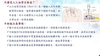 人工血管注射座