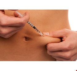 空針抽取中效胰島素注射步驟