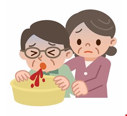 上消化道出血