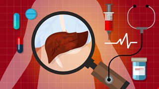 Liver Abscess 肝膿瘍