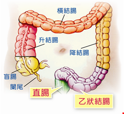 我要做大腸鏡，服用GI Klean腸見淨藥粉清腸，我要注意什麼？