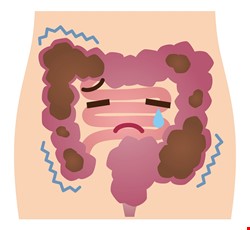Gastrointestinal Tract (GI) Series 腸胃道鋇劑攝影檢查說明