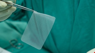 Prosthetic Mesh Surgery Care 人工網膜術後衛教說明