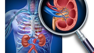 Introduction to Renal Biopsy 腎臟穿刺切片檢查說明