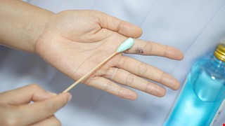 Precautions after Skin Biopsy 皮膚切片檢查後注意事項