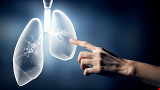 Lung Perfusion and Vertilation Scan 核醫肺部灌注暨通氣檢查