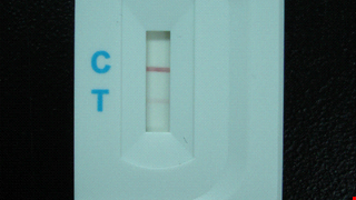 Quick Diagnosis of Venomous Snake Bites 毒蛇咬傷的快速診斷