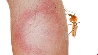 Guidelines for Travelers to Malaria-endemic Areas 旅客赴瘧疾流行地區須知