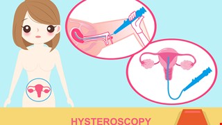 Hysteroscope examination 子宮鏡檢查