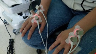 On-venous Laser Irradiation of Blood (OLIB) 經皮式靜脈雷射治療