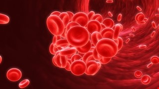 Thalassemia 地中海型貧血