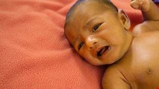 G6PD deficiency (Glucose-6-Phosphate Dehydrogenase deficiency) G-6-PD缺乏症(蠶豆症)