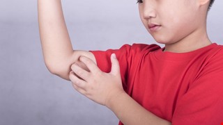 Wet-Wrap Therapy 濕敷療法