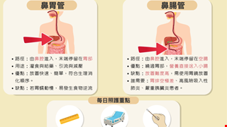 營養傳送門「認識鼻胃管與鼻腸管」/MICU