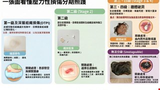 一張圖看懂壓力性損傷分期照護/NSCU