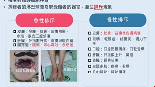 什麼是移植物抗宿主疾病 GVHD?/8I