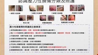 預防壓力性損傷/10I