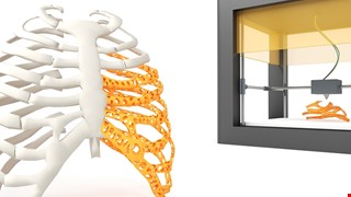 迎接數位醫療新浪潮 手術到復健3D列印無所不在