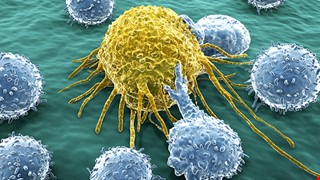 自體免疫細胞治療迎戰肝癌