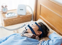 治療阻塞性睡眠呼吸中止症 除了陽壓呼吸器之外的選擇