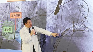 中醫大兒醫完成全台最年輕「經導管三尖瓣瓣中瓣」微創手術 12歲童免再開心手術 健康重返校園生活