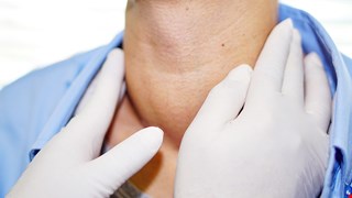 甲狀腺囊腫酒精注射治療